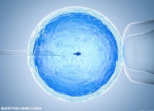 多囊卵巢案例